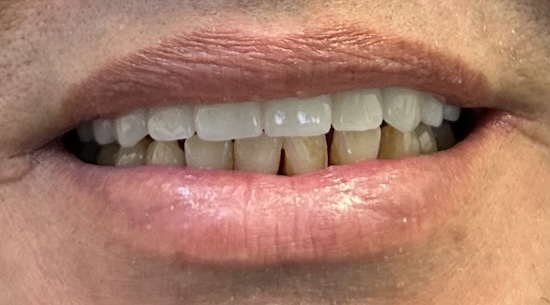 smile gallery image