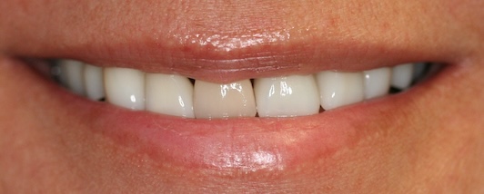 smile gallery image