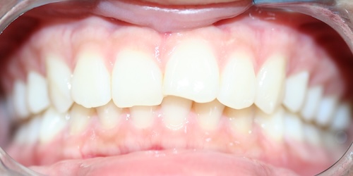 smile gallery image