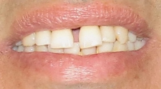 smile gallery image