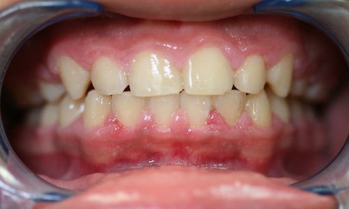 smile gallery image