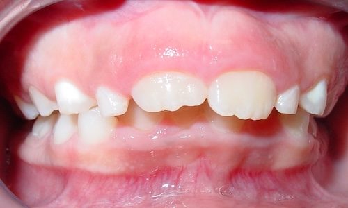 smile gallery image