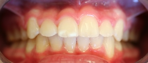 smile gallery image