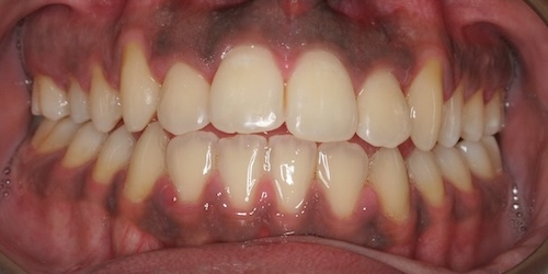smile gallery image