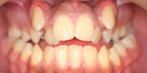smile gallery image
