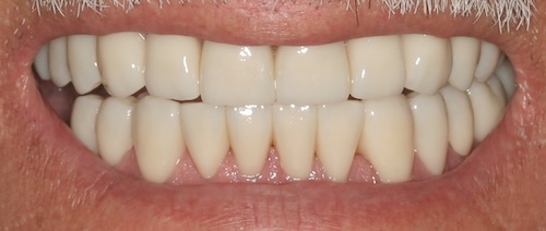 smile gallery image