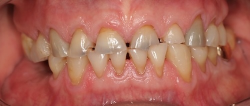 smile gallery image