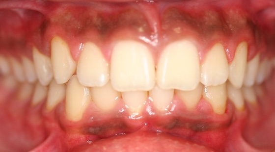 smile gallery image