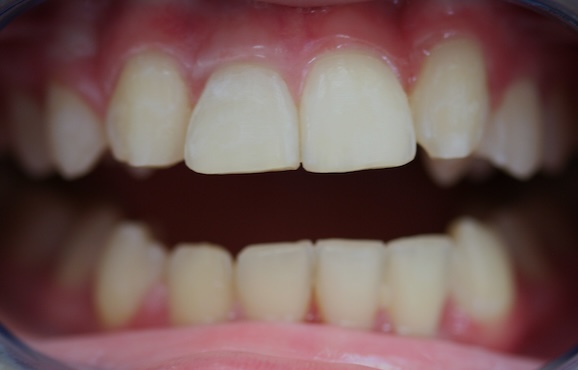 smile gallery image