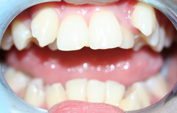smile gallery image