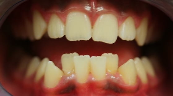 smile gallery image