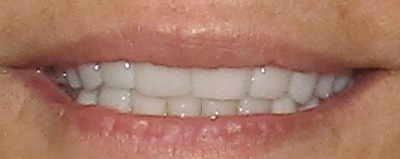 smile gallery image