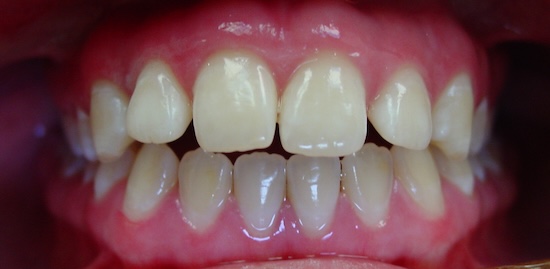 smile gallery image