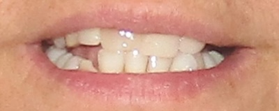 smile gallery image
