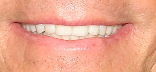 smile gallery image