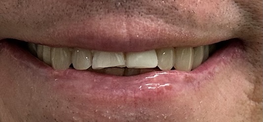 smile gallery image