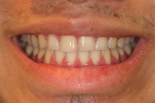 smile gallery image