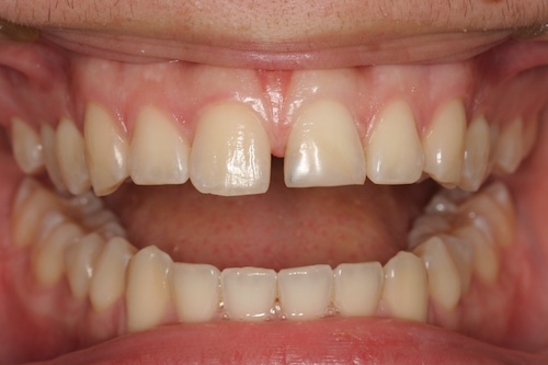 smile gallery image