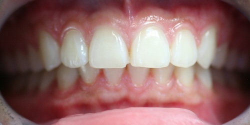 smile gallery image