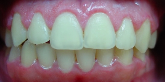 smile gallery image