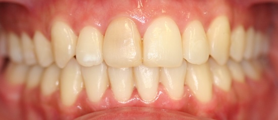 smile gallery image