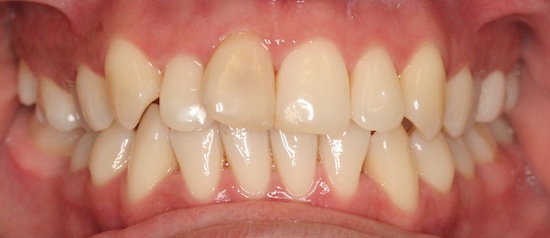 smile gallery image