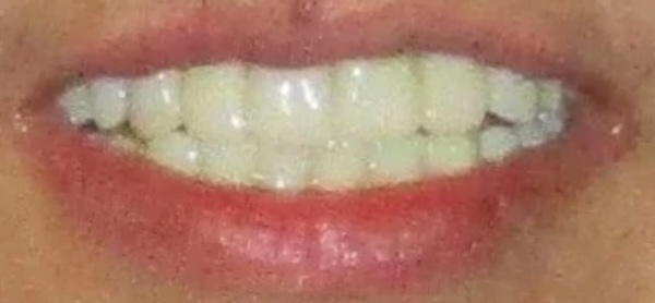 smile gallery image