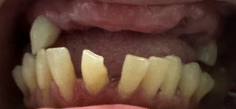 smile gallery image