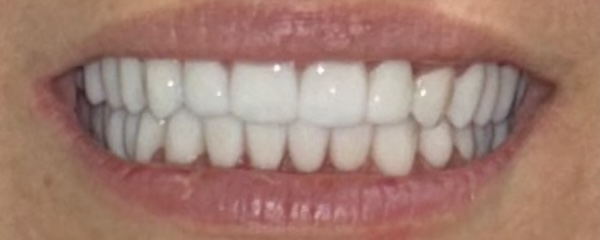 smile gallery image