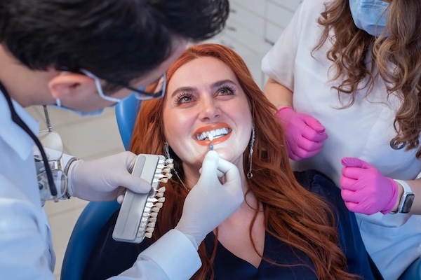 Veneers